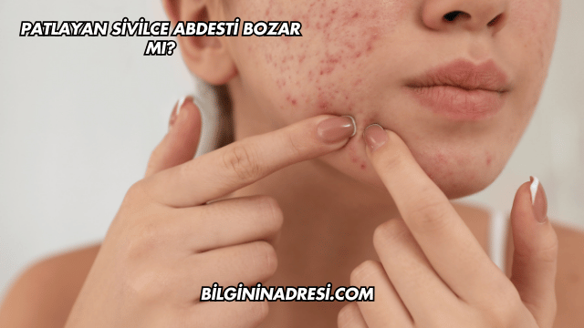 Patlayan Sivilce Abdesti Bozar mı?