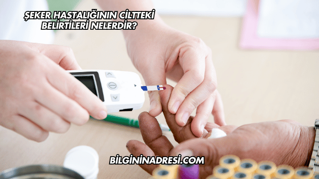Şeker Hastalığının Ciltteki Belirtileri Nelerdir?