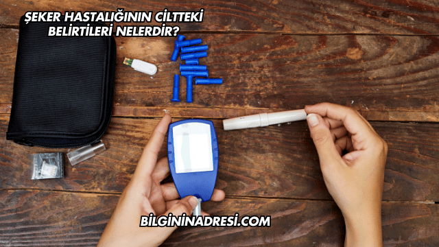 Şeker Hastalığının Ciltteki Belirtileri Nelerdir?