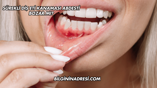 Sürekli Diş Eti Kanaması Abdesti Bozar mı?