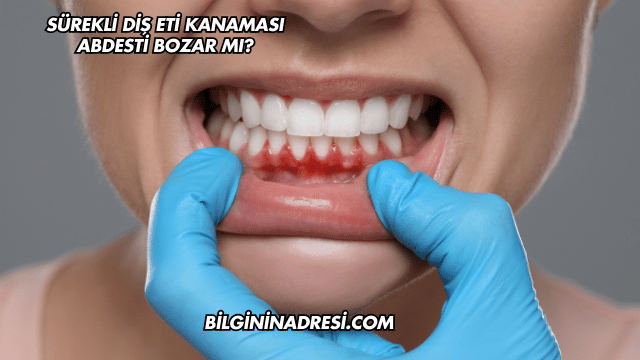 Sürekli Diş Eti Kanaması Abdesti Bozar mı?