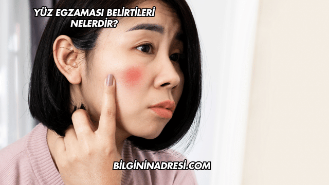 Yüz Egzaması Belirtileri Nelerdir?