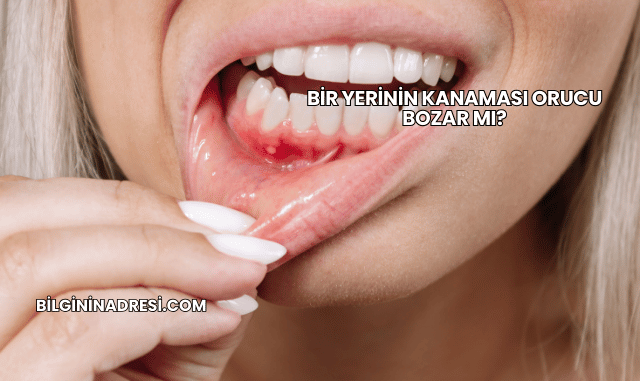 Bir Yerinin Kanaması Orucu Bozar mı?