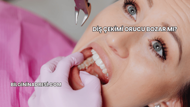 Diş Çekimi Orucu Bozar mı?