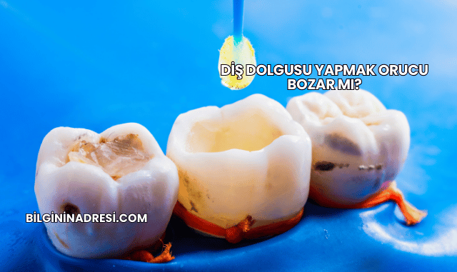 Diş Dolgusu Yapmak Orucu Bozar mı?