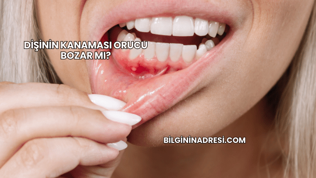 Dişinin Kanaması Orucu Bozar mı?