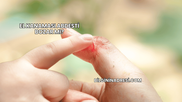 El Kanaması Abdesti Bozar mı?
