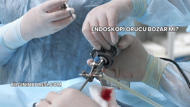 Endoskopi Orucu Bozar mı?