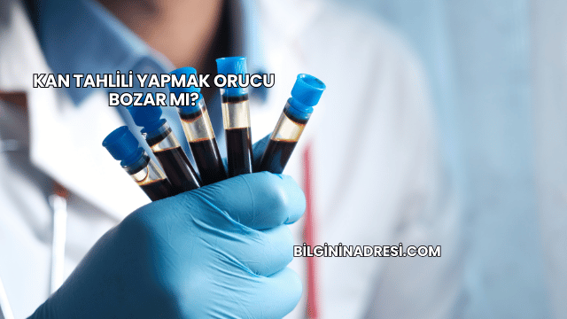 Kan Tahlili Yapmak Orucu Bozar mı?