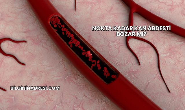 Nokta Kadar Kan Abdesti Bozar mı?