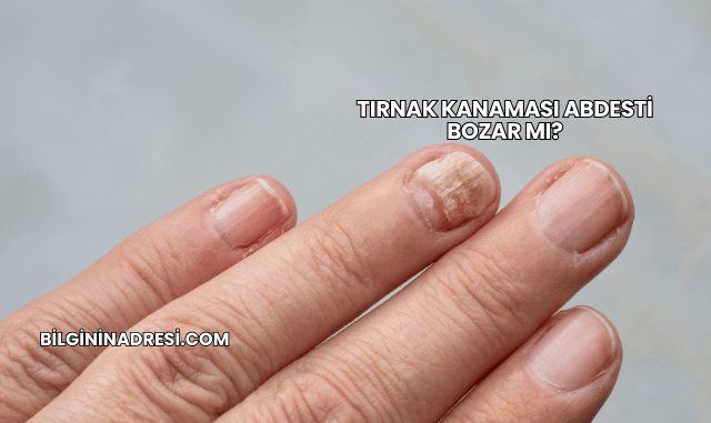 Tırnak Kanaması Abdesti Bozar mı?