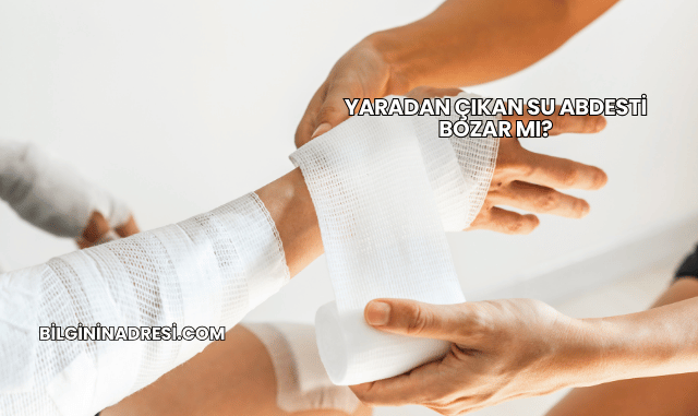 Yaradan Çıkan Su Abdesti Bozar mı?